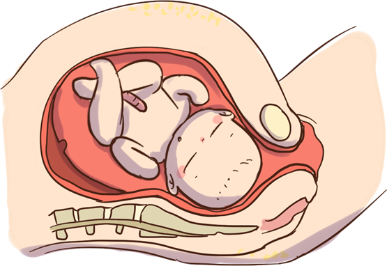 麦澜德观察 | 子宫脱垂是什么 麦特斯磁刺激仪助力女性盆底康复